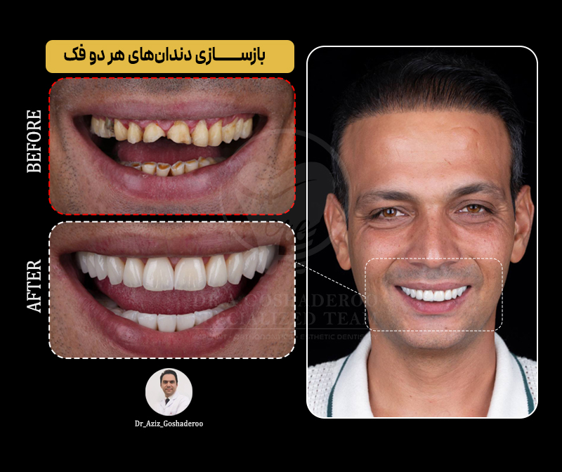 دندانپزشکی زیبایی